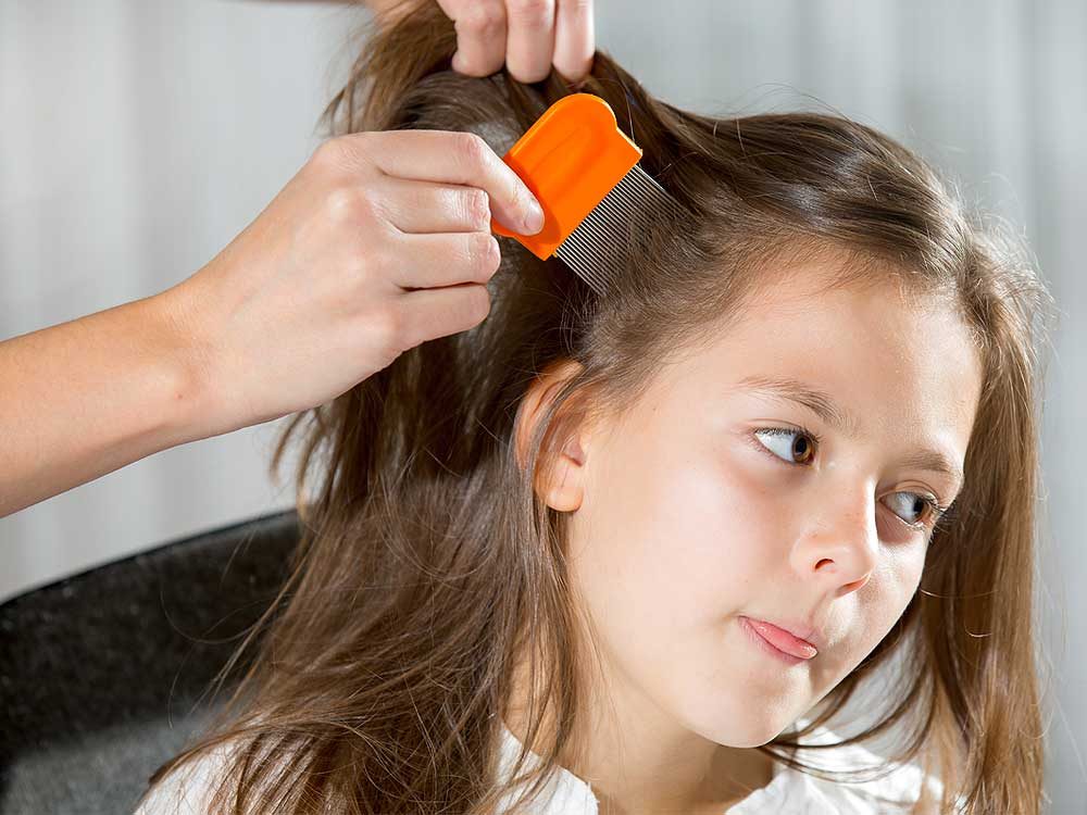 Beat the Bugs: How to Treat Head Lice in 8 Steps