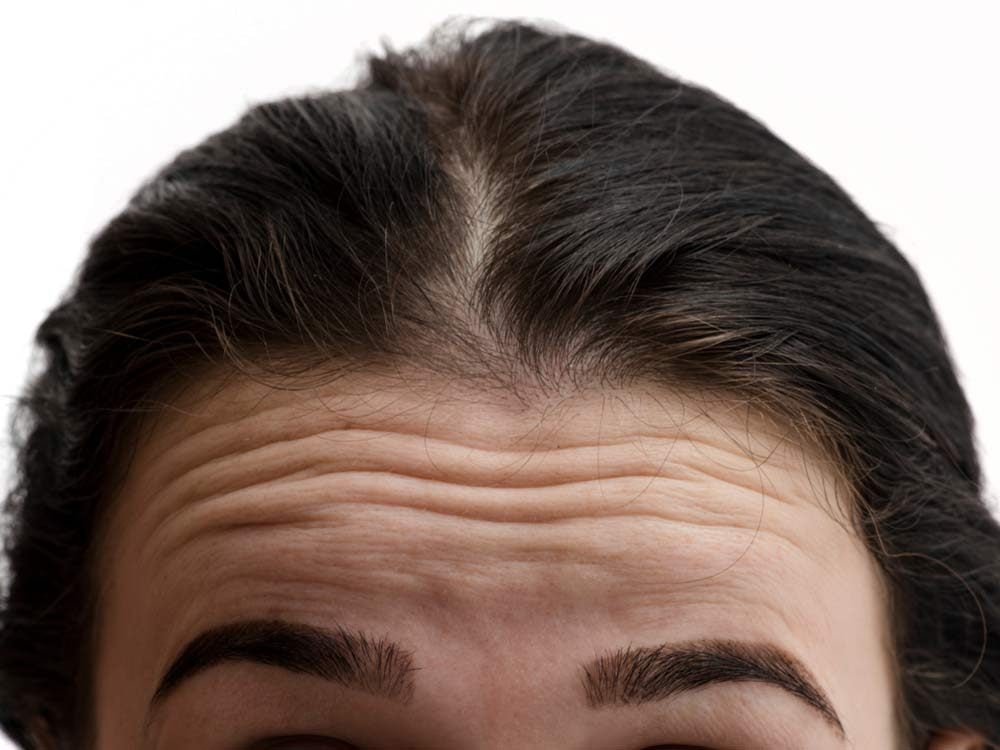 First wrinkles on forehead