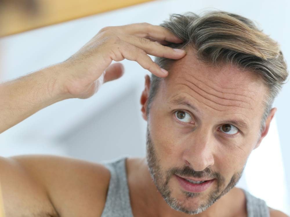 Man spotting hair loss in mirror