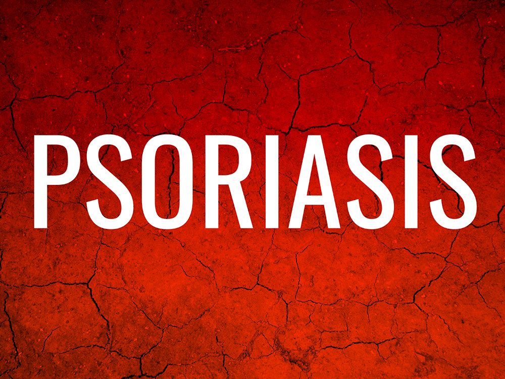 Rash identifier: Psoriasis
