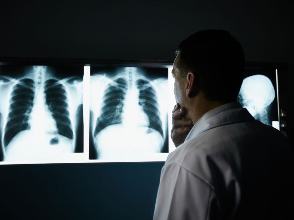 Doctor examining CT scans of lungs