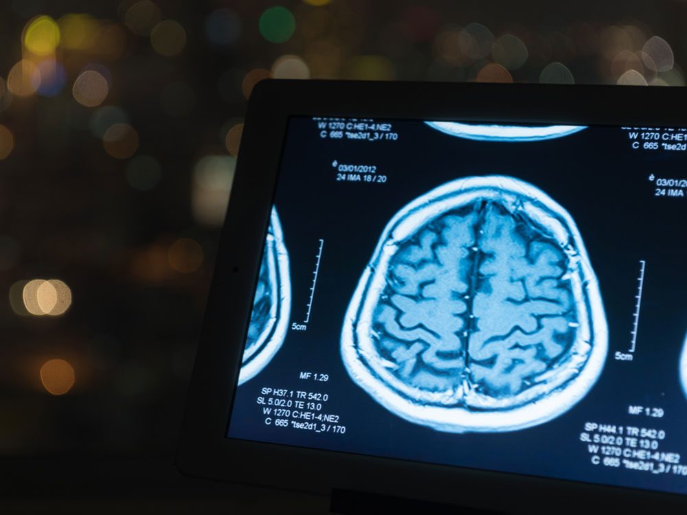 Magnetic scan of brain on tablet device