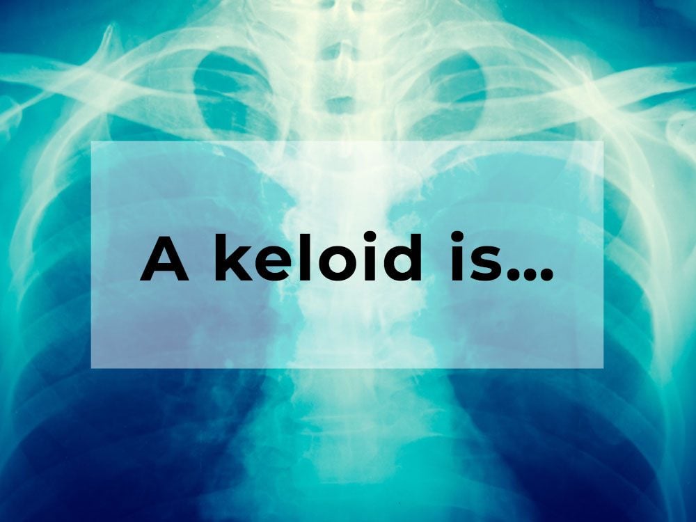 What is a keloid?