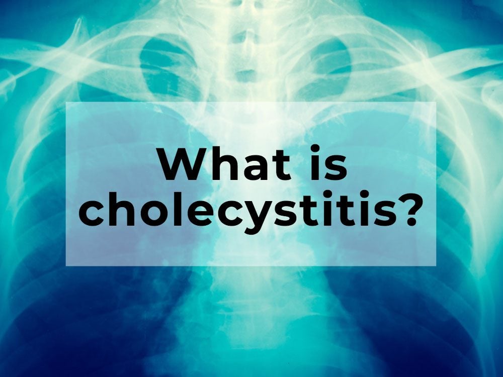 What is cholecystitis?