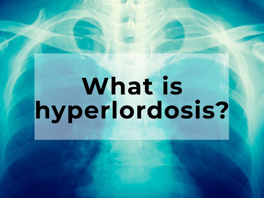 What is hyperlordosis?