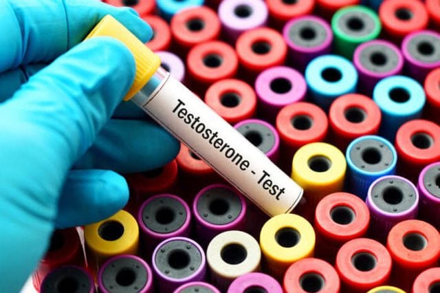 Testosterone hormone test