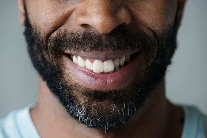 Closeup of smiling teeth of a black man