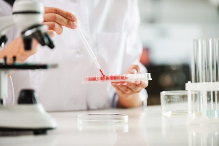 Testing your blood. Close-up of female scientist in white uniform holding microtiter plate while working in the laboratory
