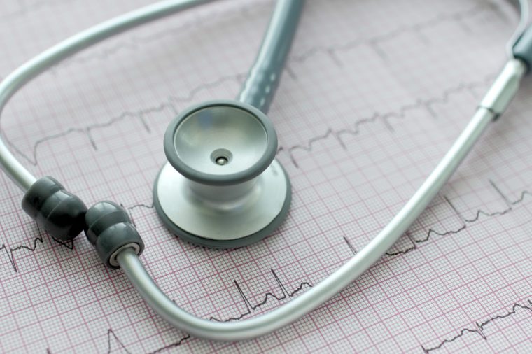 Heartbeat line (EKG)