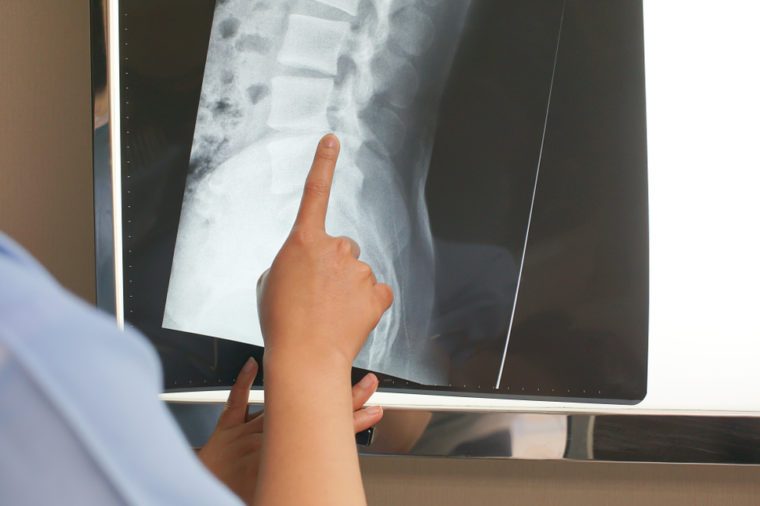 Doctor holding x-ray