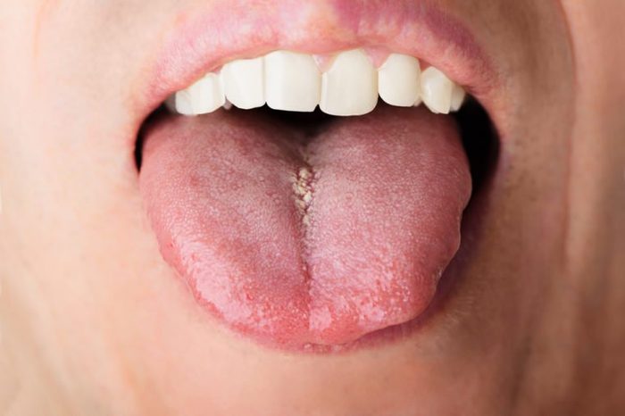Closeup photo of man showing his tongue