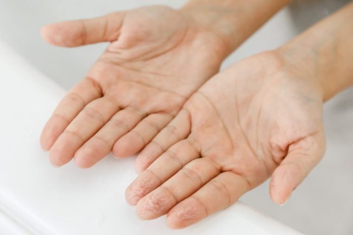 Comparison of female hands with wrinkles after bath