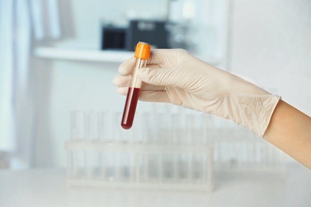 Doctor hand in glove holding test tube with blood on blurred background