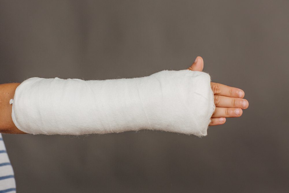 Close-up of a broken arm in a cast on grey background