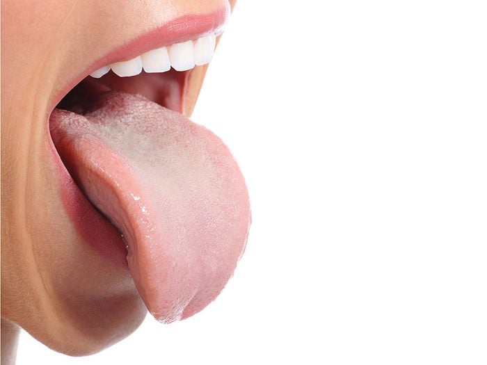 How to get rid of hiccups - stick out your tongue