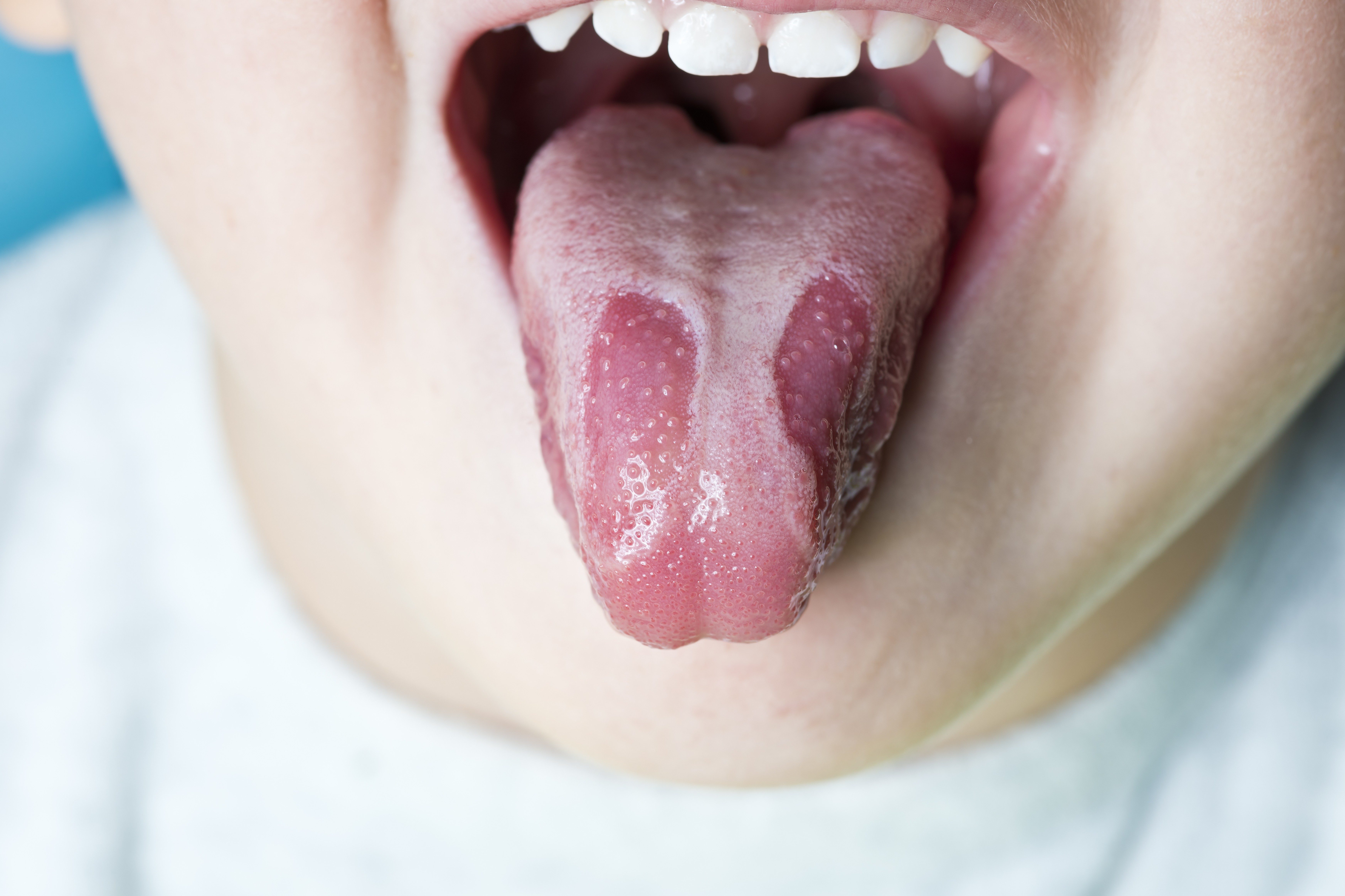 Tongue clues