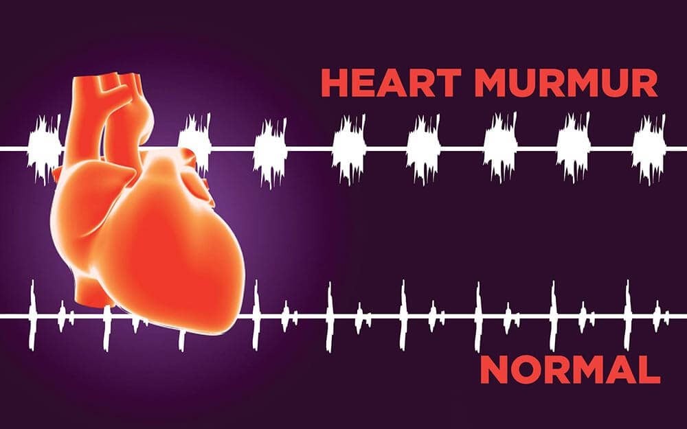 8 Silent Signs You May Have Heart Murmur Readers Digest Canada 