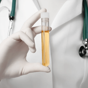 Why your pee smells funny - Gloved doctor holding test tube of pee