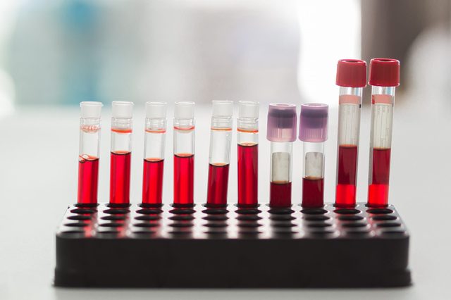 Blood Test tubes in laboratory , in the hospital.