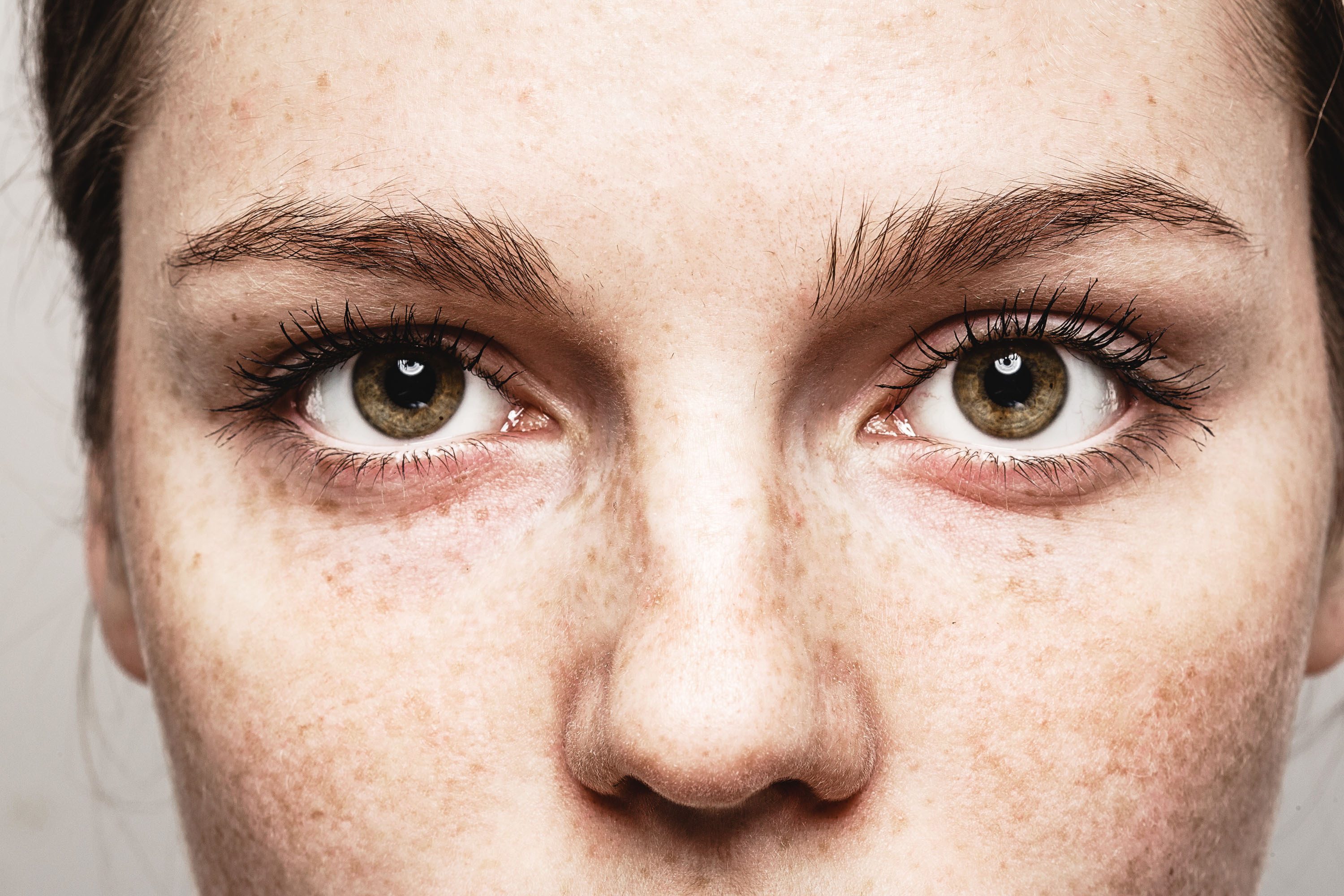 Close-up of freckles and eyes of woman