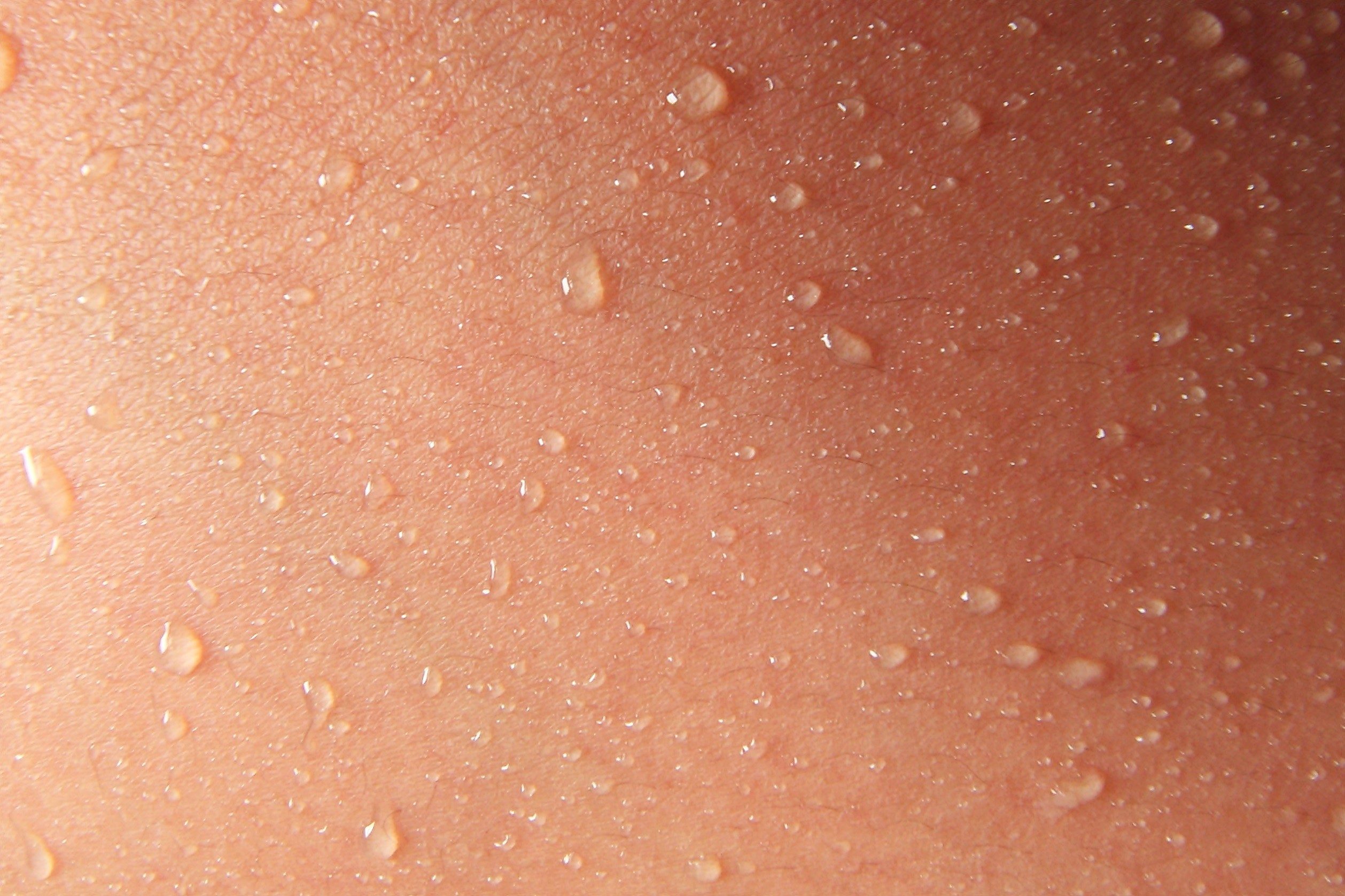 Close-up of sweating skin