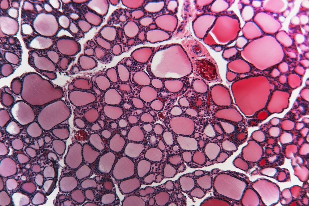 Cell thyroid gland dog- abstract science. Biology nature structure: medical and biological tissue prepared microscope slide; educational material for the study and treatment of animals.