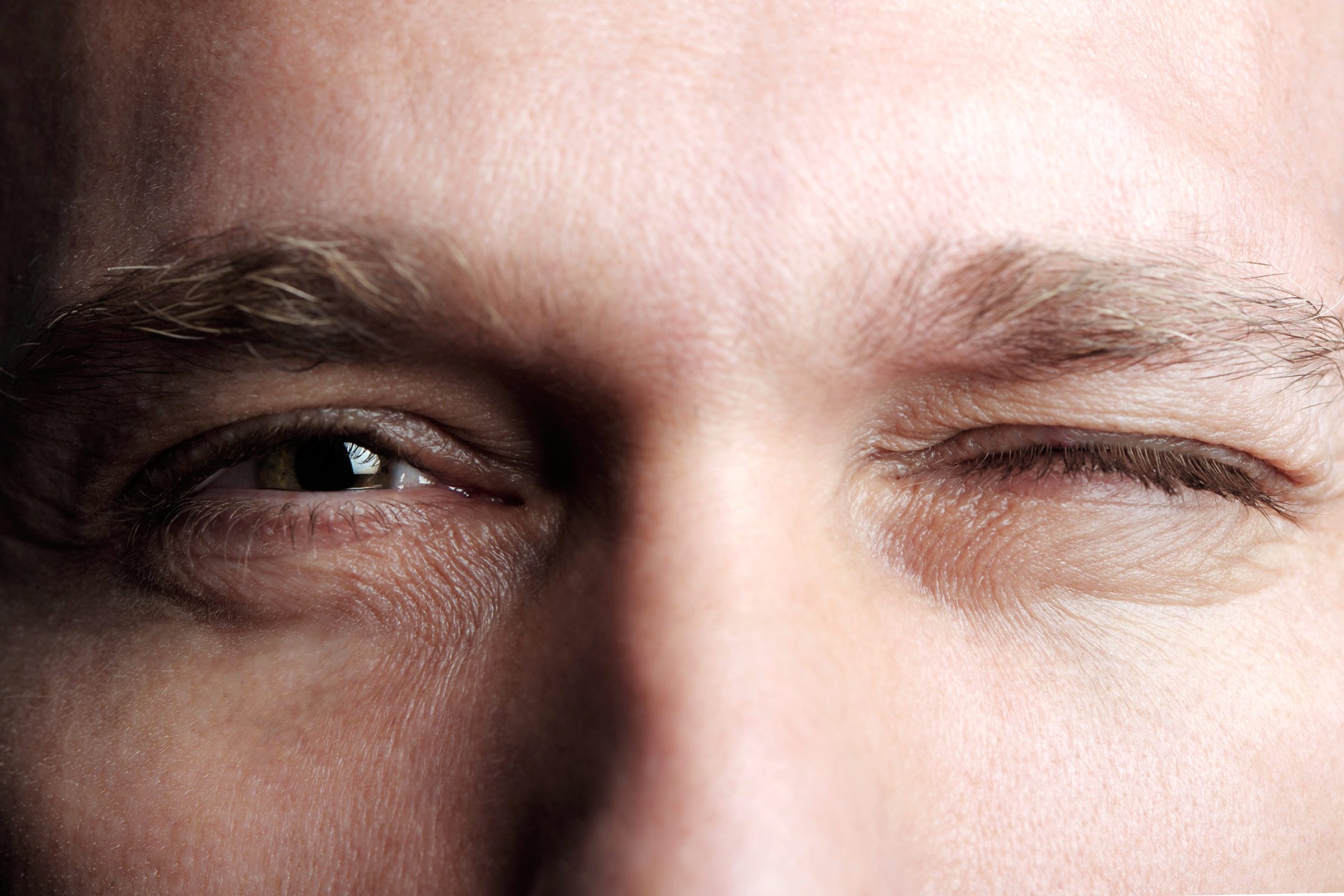 concussion symptoms man eyes pupils