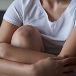Do You Tend to Bruise Easily? Here Are the Likely Reasons Why