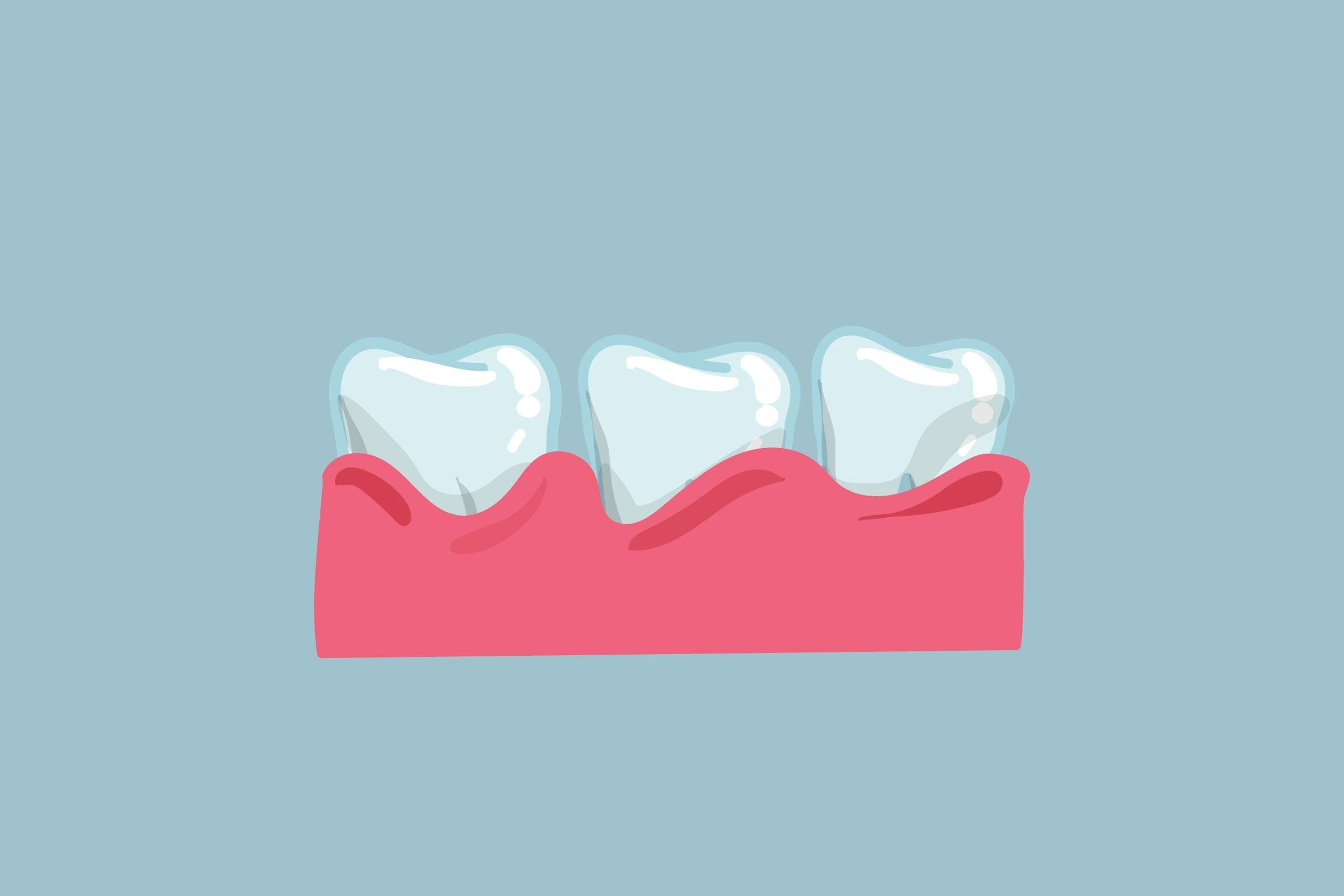 gum disease inflamed teeth