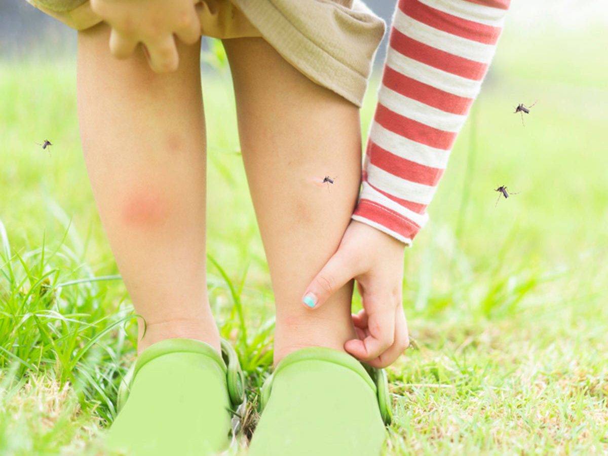 Mosquito bite allergy - girl brushing mosquitoes off leg