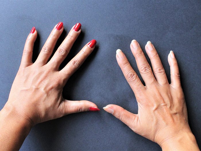 Hands with and without nail polish