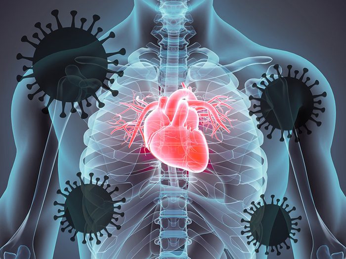 Coronavirus heart damage - body graphic