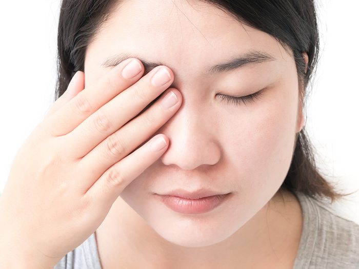 Shingles signs - woman with one sore eye