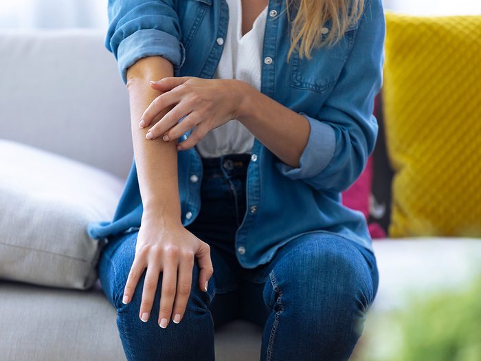 Symptoms of shingles - woman scratching arm