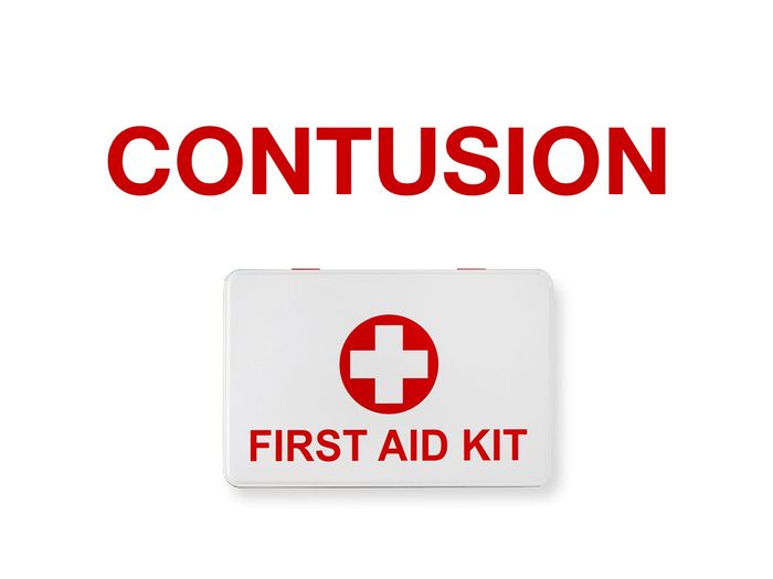 First aid quiz - contusion