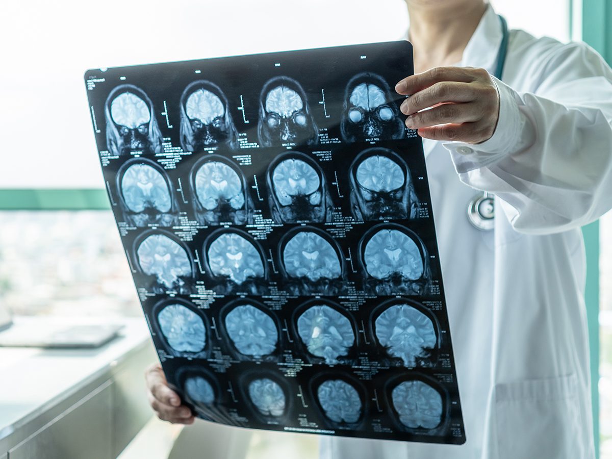 Neurologist doctor examining MRI of brain