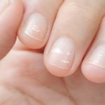 What It Could Mean If You Have White Spots on Your Nails
