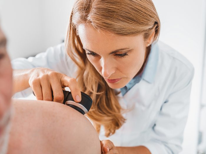 When to see your doctor - Doctor dermatologist examines skin of patient. Dermatoscopy, prevention of melanoma, skin cancer.