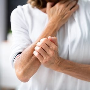 Skin rashes - woman itching arm