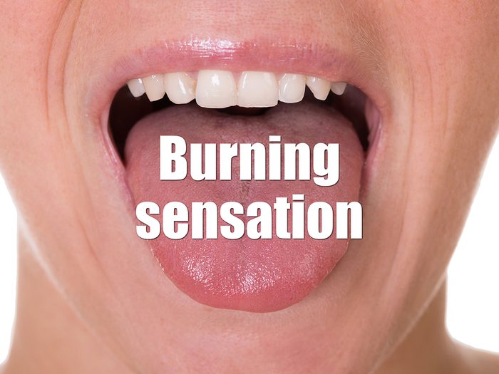 Health Clues Tongue - Burning