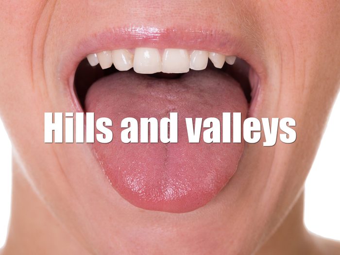 Health Clues Tongue - Hills And Valleys