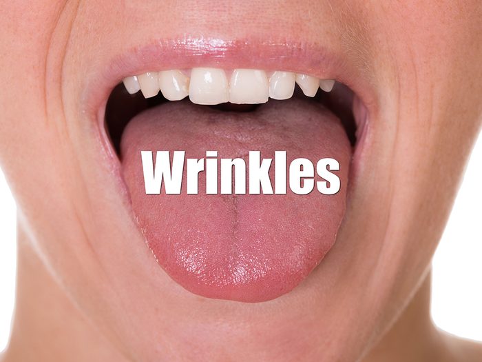 Health Clues Tongue - Wrinkles