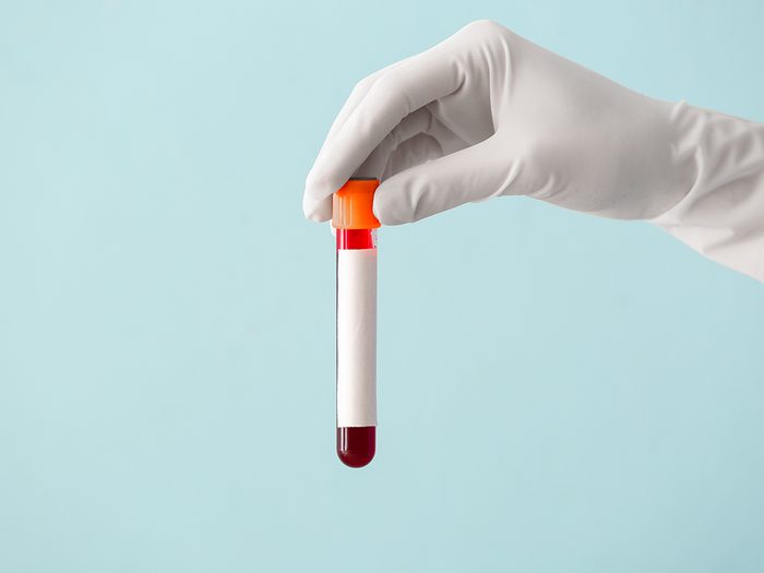 Alzheimer's blood test - test tube filled with blood
