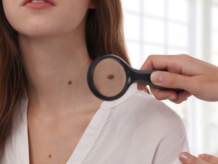 Skin Cancer Symptoms - Person examining woman's neck