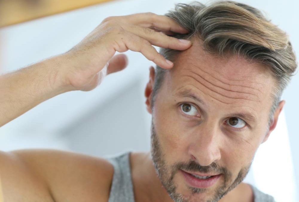 10 Ways To Prevent Hair Loss In Men Reader S Digest